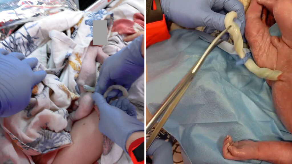 “È un aborto”, ma i soccorritori salvano il bambino in extremis in ambulanza